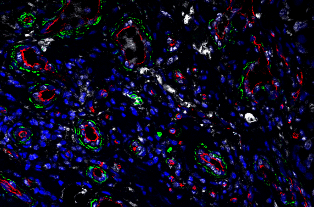 A digital image of fibroblasts